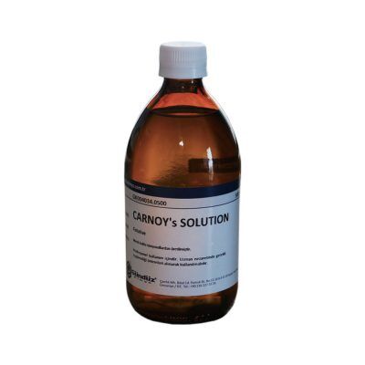 Carnoy's Solution for odontogenic keratocyst